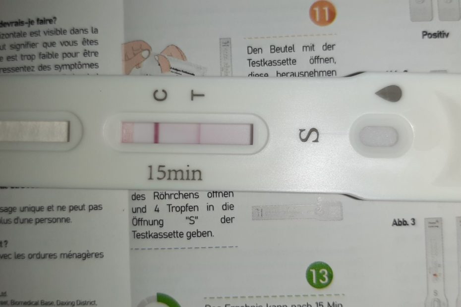 Test PCR BTSa ANABIOTEC